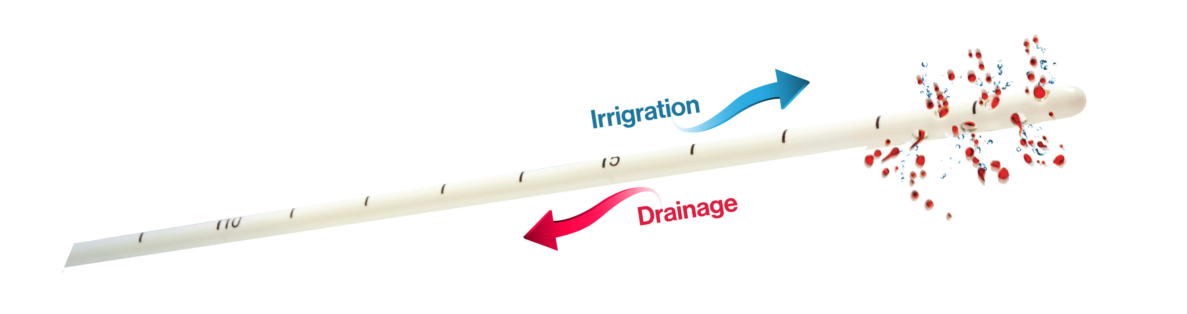 Neurological Fluid Management Technology - IRRAS irrigation illustration