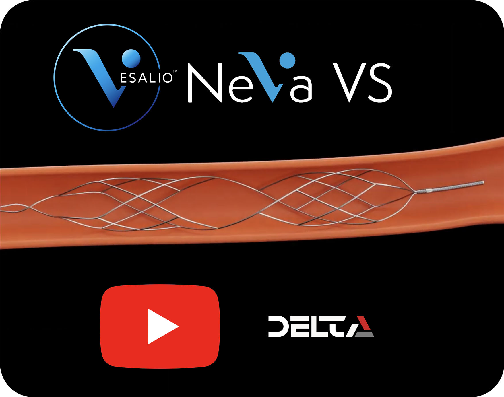 P14e Neva VS video 1