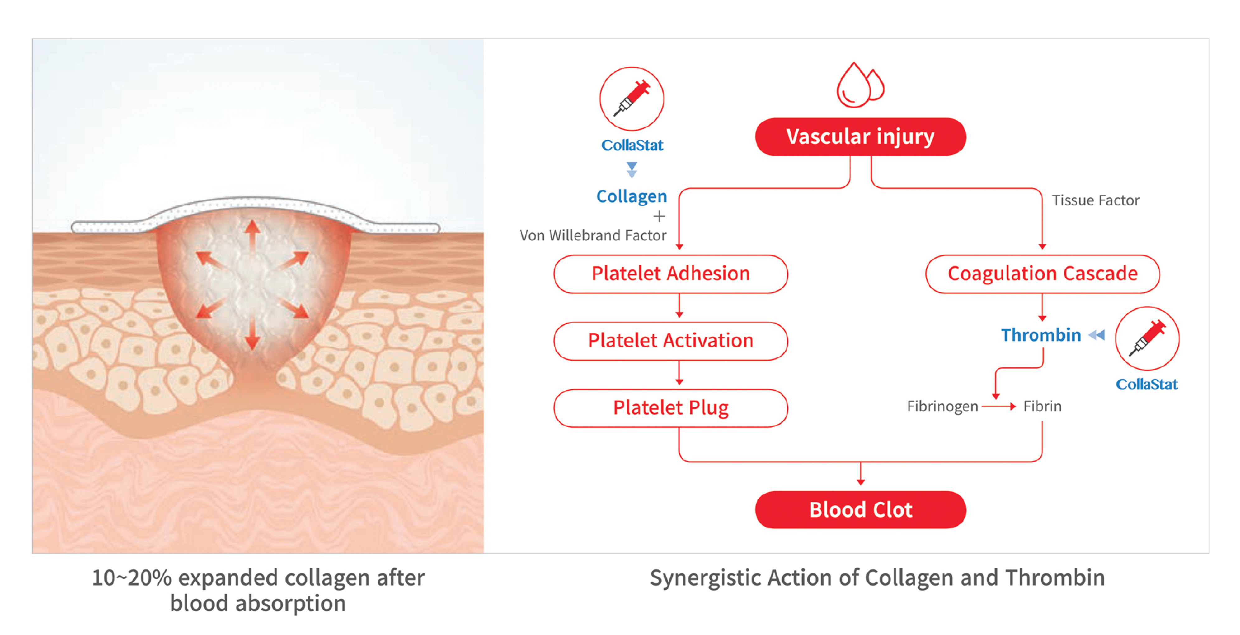 P15b Collastat lower illustration