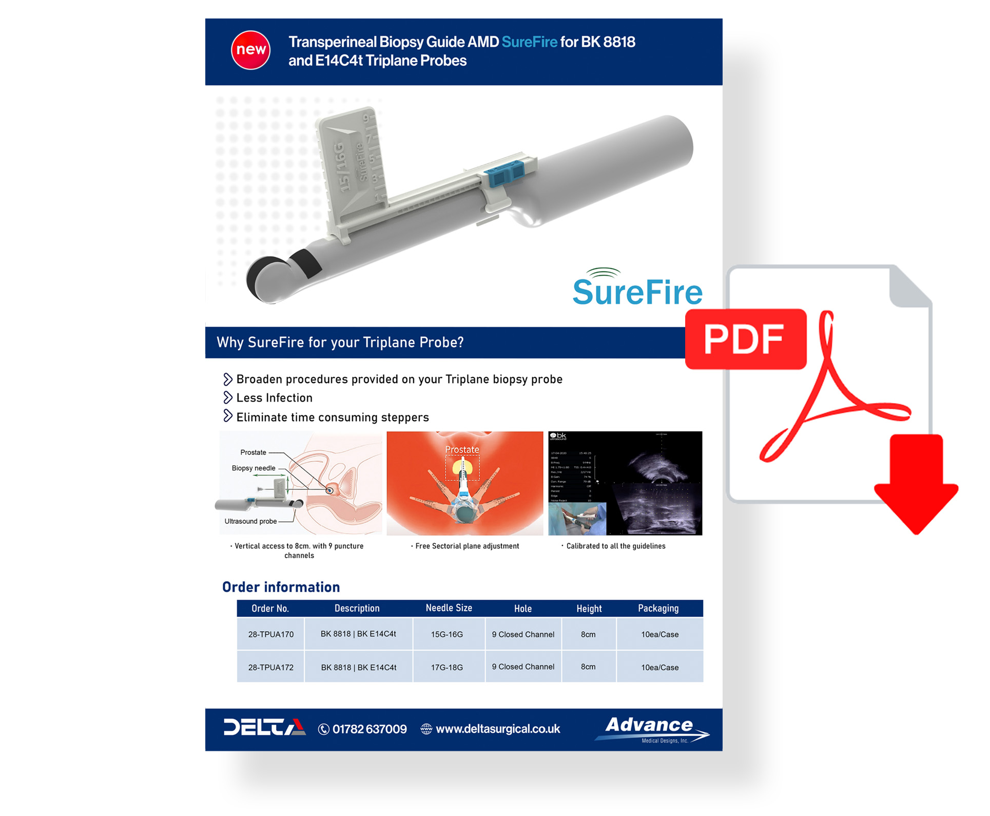 P15 Urology - BK8818 PDF & BK 8818 Vid link