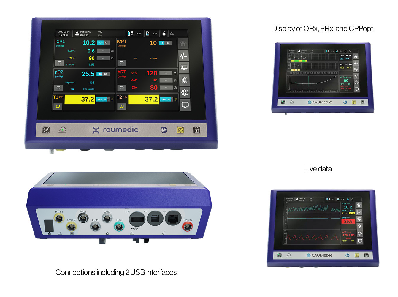 P4 NeuroSmart, DATALOGGER & EASY logO for Neuromonitoring