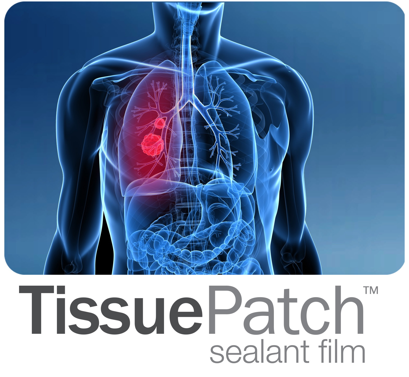 P9 - Pic 4 Thoracic (including Thoracoscopic) Surgery